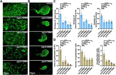 Association analysis and functional follow-up identified common variants of JAG1 accounting for risk to biliary atresia